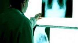 Milano, concorso per 8 Tecnici di Radiologia