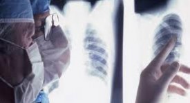 inail-rimborso-delle-cure-per-infortuni-e-malattie-professionali